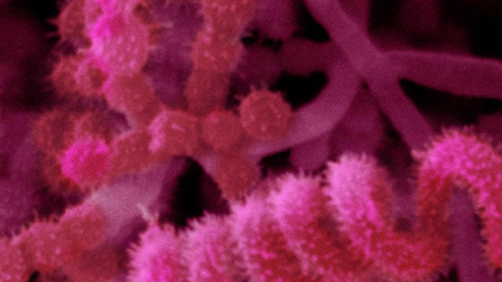 actinomycete